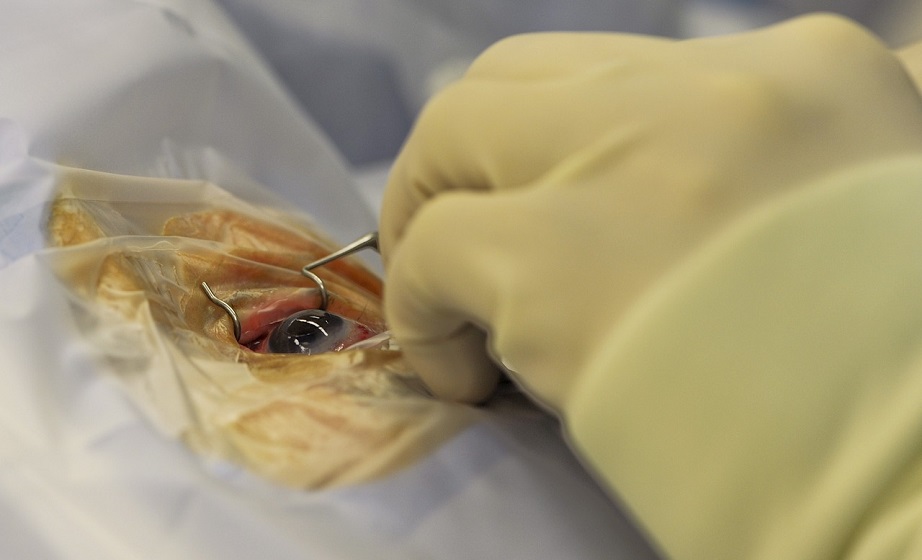 gesundheitssytem_augenoperation_gesundheitswesen_hygiene_hygienemangel_krankenhaus_krankenhausinfektionen_infektionen_kritisches_netzwerk_wundinfektion_pflegemangel.jpg