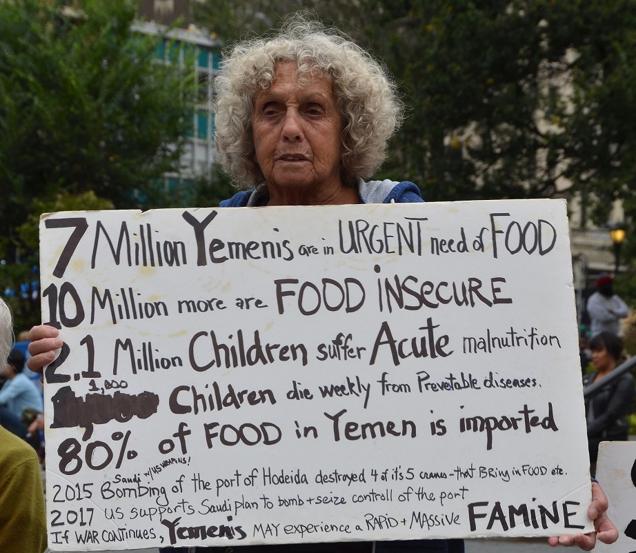 jemen_yemen_yemenis_food_insecure_malnutrition_unterernaehrung_preventable_diseases_krankheiten_kinder_cholera_kritisches_netzwerk_humanitaere_hilfe_war_crimes_kriegsverbrechen.jpg
