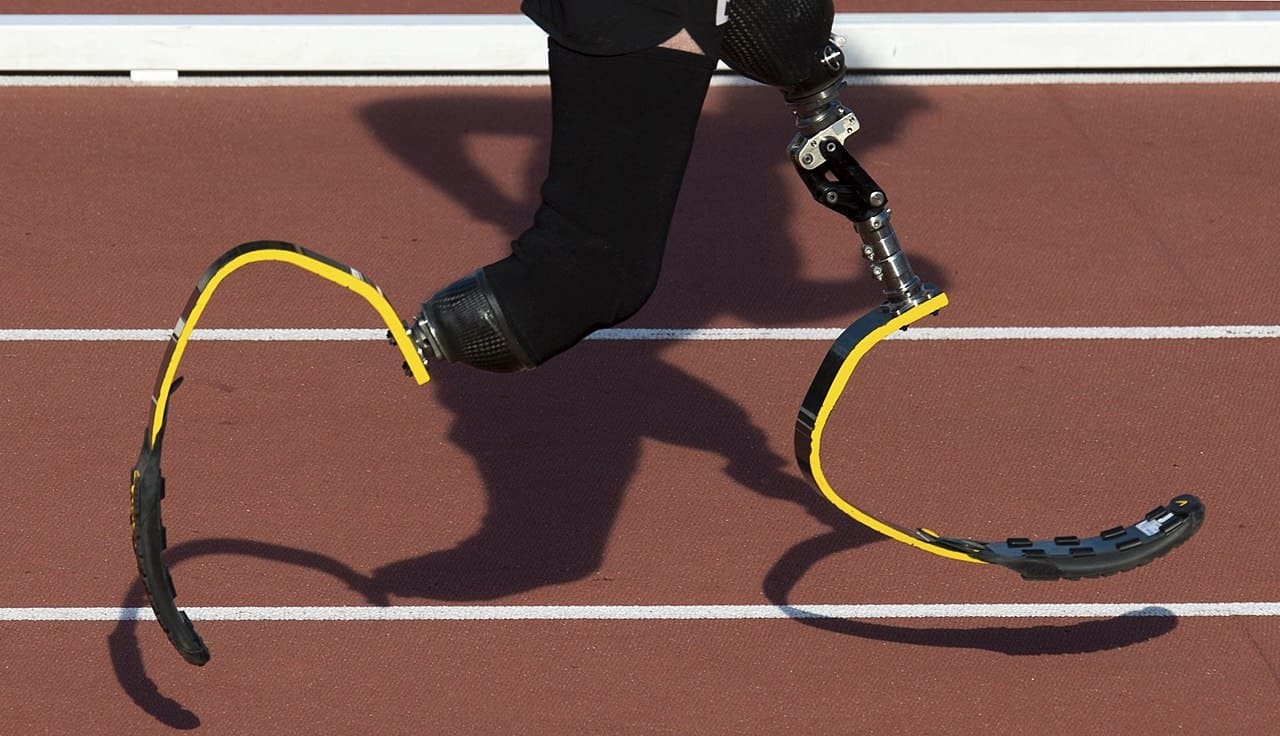 kybernetische-Prothese-Prothesen-Armprothesen-Beinprothesen-chipgesteuerte-Elektromechanik-Neuroprothesen-Kritisches-Netzwerk-Robotik-kuenstliche-Extremitaeten