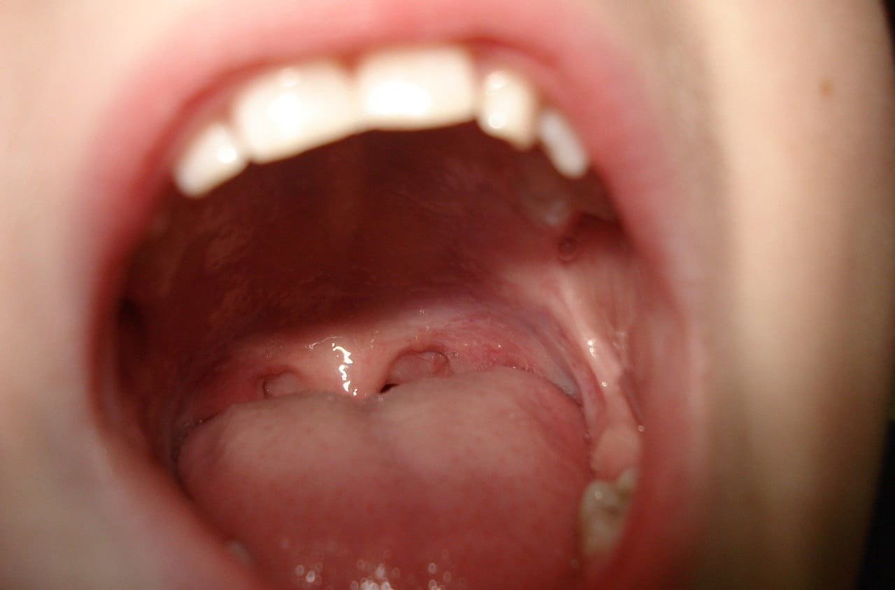 Mund_Mundraum_Mundhoehle_Rachen_Rachenraum_Lippen_Aerosolpartikel_Atemtiefe_Schlundrachen_Gaumenbogen_Nasenrachenraum_Rueckatmung_Kritisches-Netzwerk