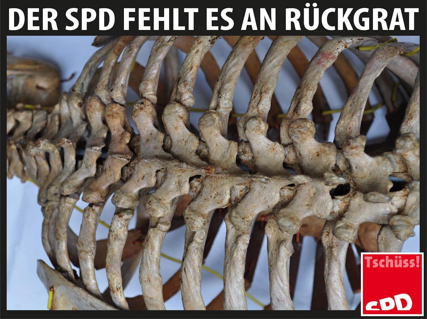 SPD-Rueckgrat-1-Sozialchauvisten-Sozialdemokraten-Sozialdemokratie-soziale-Schieflage-Verelendung-sozialer-Kahlschag-Sozialverraeter-Kritisches-Netzwerk-Prekariat